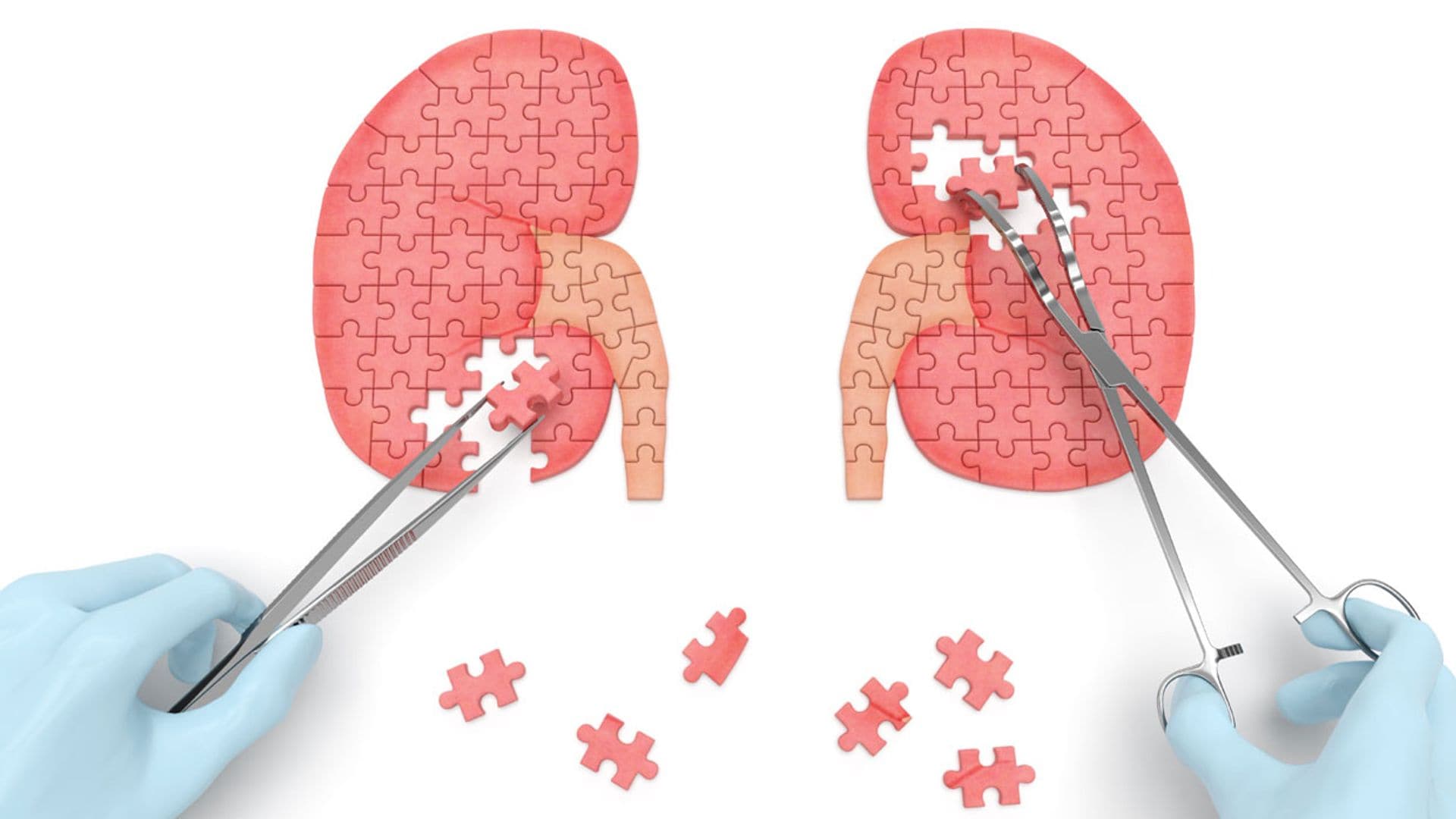 ¿Qué es un linfoma renal, el cáncer que sufre Paco, el segundo hijo de Lorenzo Sanz?