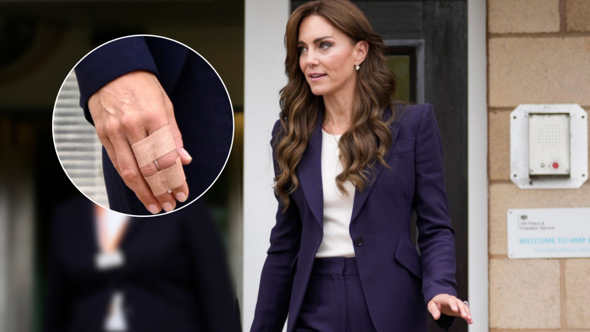 El motivo por el que la princesa de Gales ha llevado vendada su mano en su última aparición pública