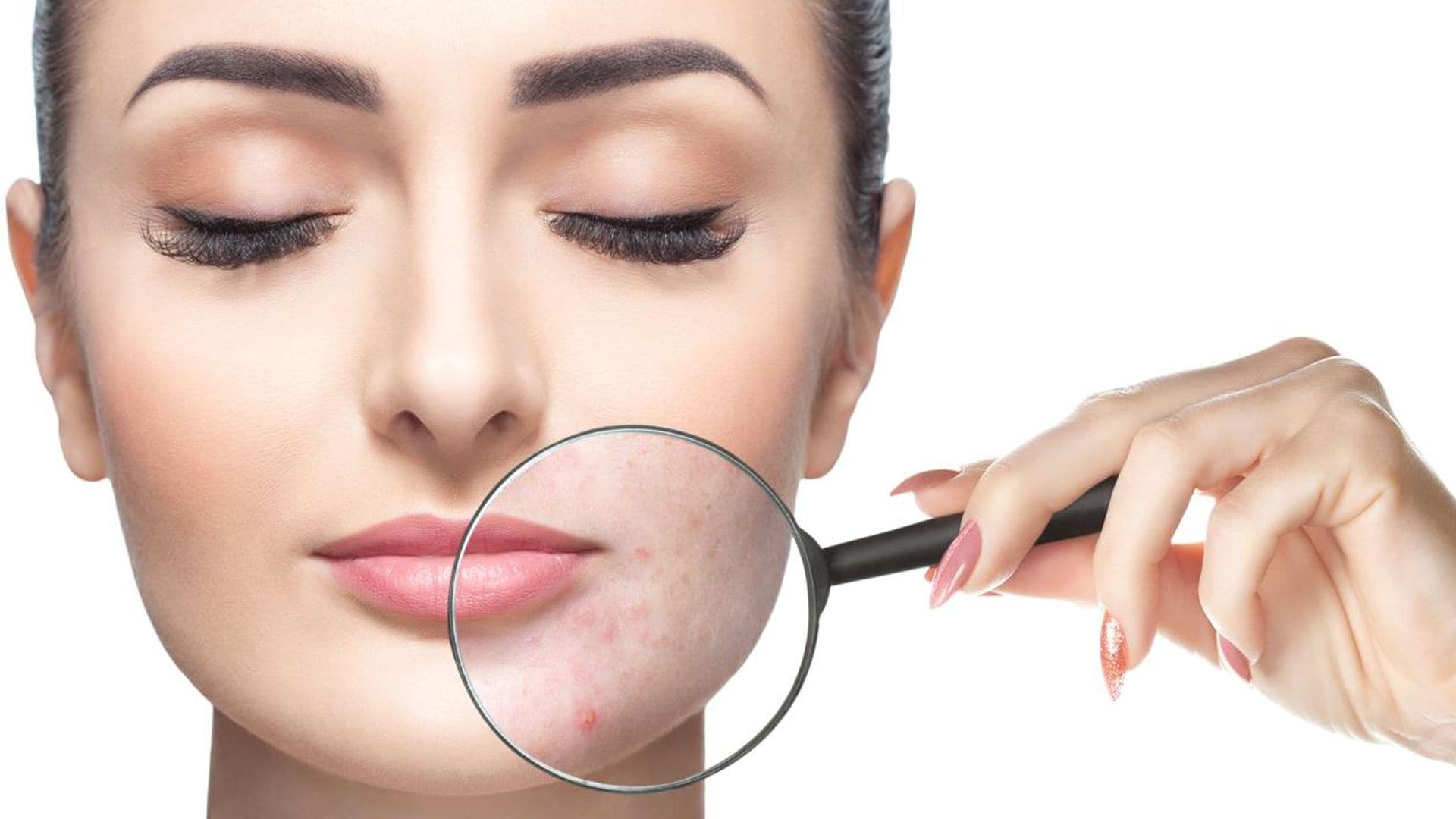 ¿Piel con acné? Mira los componentes que debes evitar en tu makeup