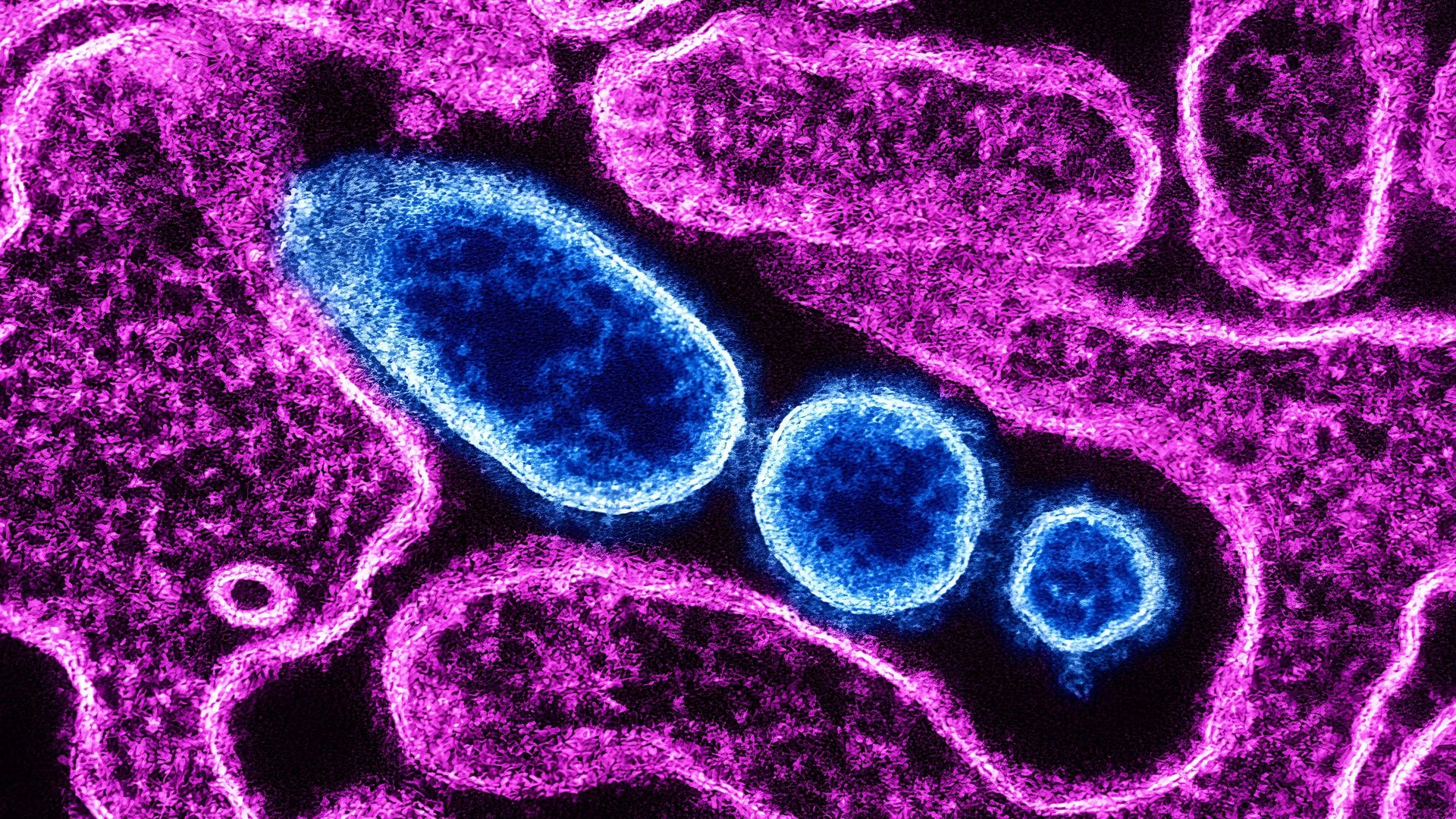 Partículas del virus Nipah