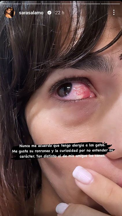 Sara Sálamo alergia gatos