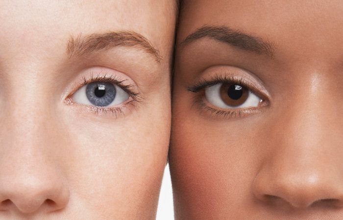 blefaroplastia