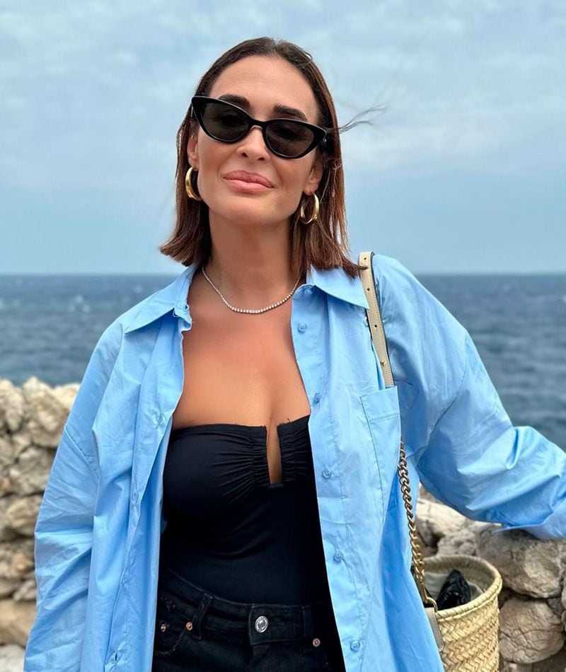 Vicky Martín Berrocal con pelo corto
