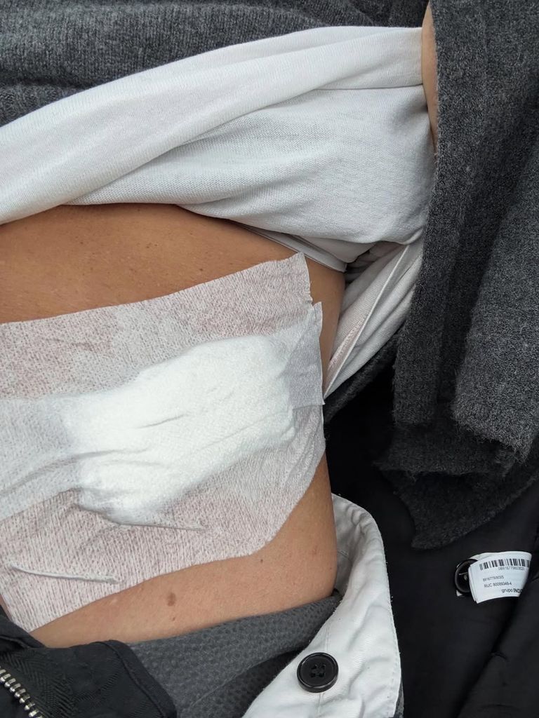 "Con lo que hay por ahí, bastante poco es lo que me ha pasado", dijo la mujer de Ion Aramendi tras la operación