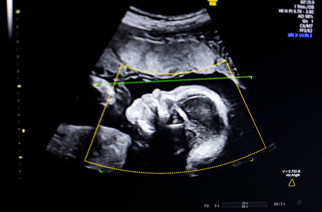 El entorno hormonal del feto en las primeras semanas de gestación influye en el desarrollo del cerebro… y podría reflejarse años después en la proporción entre el índice y el anular