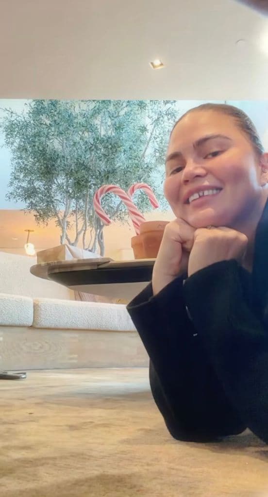 Chrissy Teigen estuvo así por un par de días, hasta que su dentista arregló el desperfecto. 