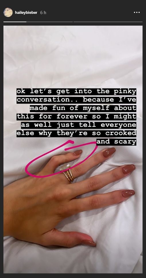 hailey baldwin dedo