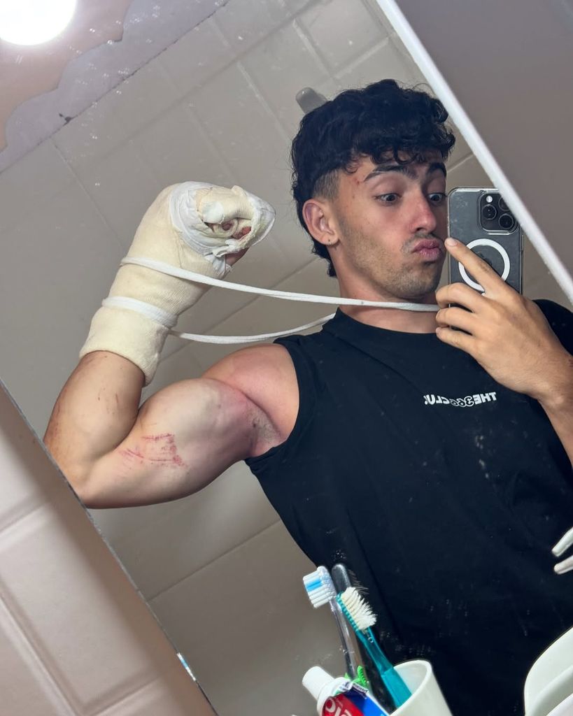 El grave accidente de Gero Arias, el 'influencer' del reto de las 366 dominadas