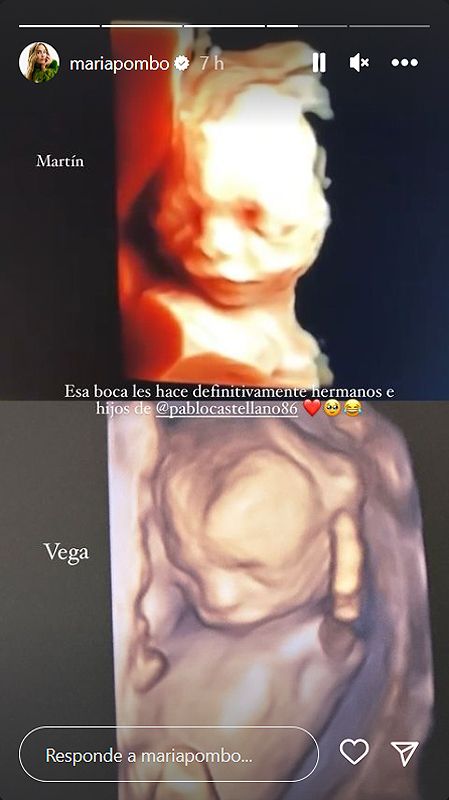 Ecografía de María Pombo