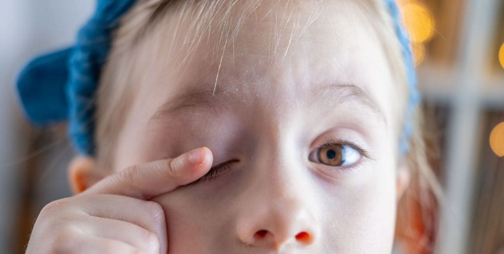 Niña con un tic en el ojo por síndrome de Tourette