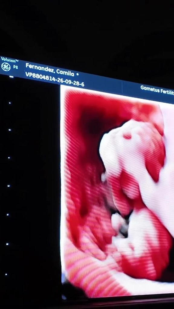 Camila Fernández mostró a su familia una ecografía. 