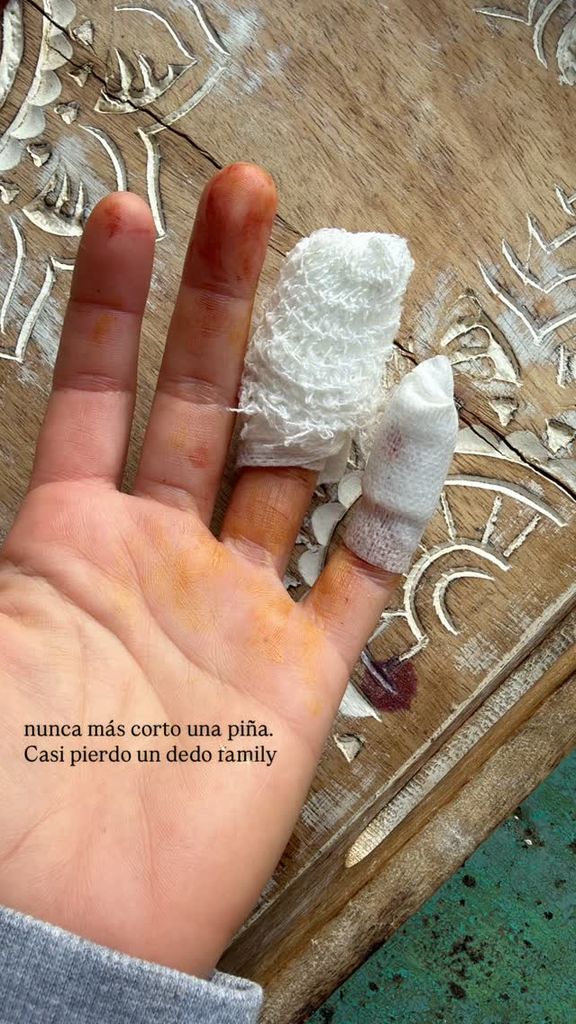 Sofía Ellar cuenta en sus redes sociales que casi se queda sin un dedo por cortar una piña