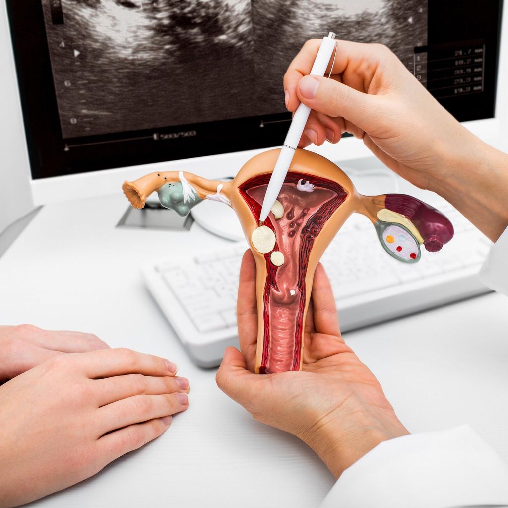 Síndrome del ovario poliquístico. Embarazo y Fertilidad.