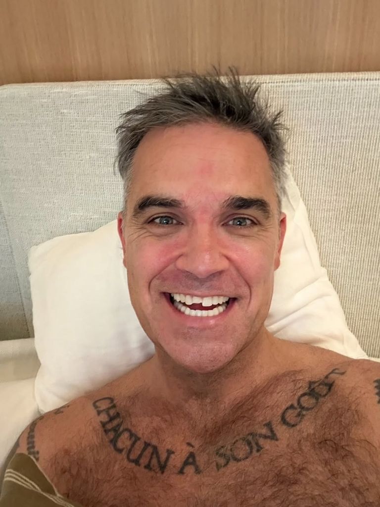 Robbie Williams muestra en una foto cómo se ha roto un diente