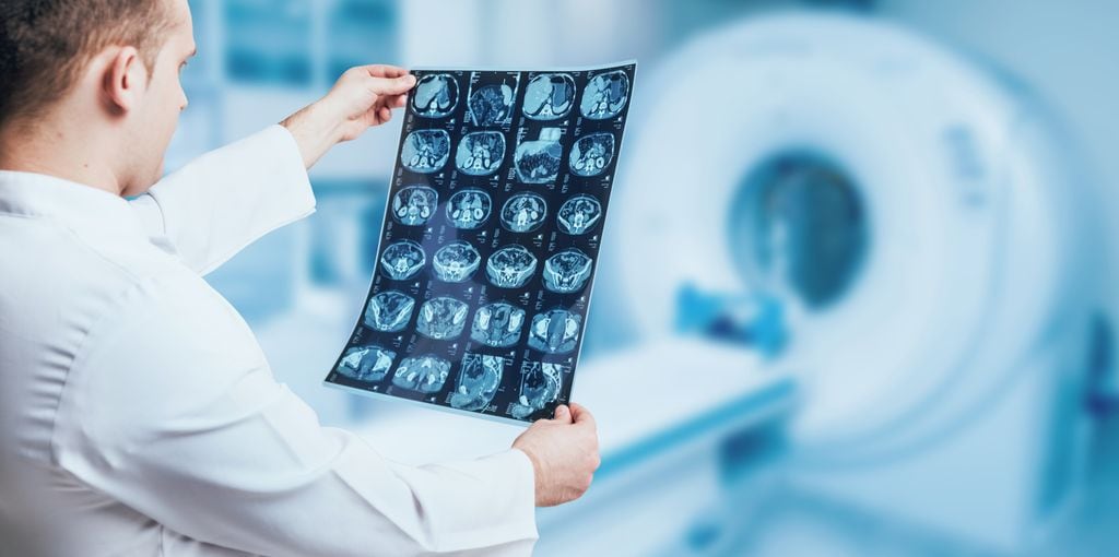 Médico examinando una resonancia magnética