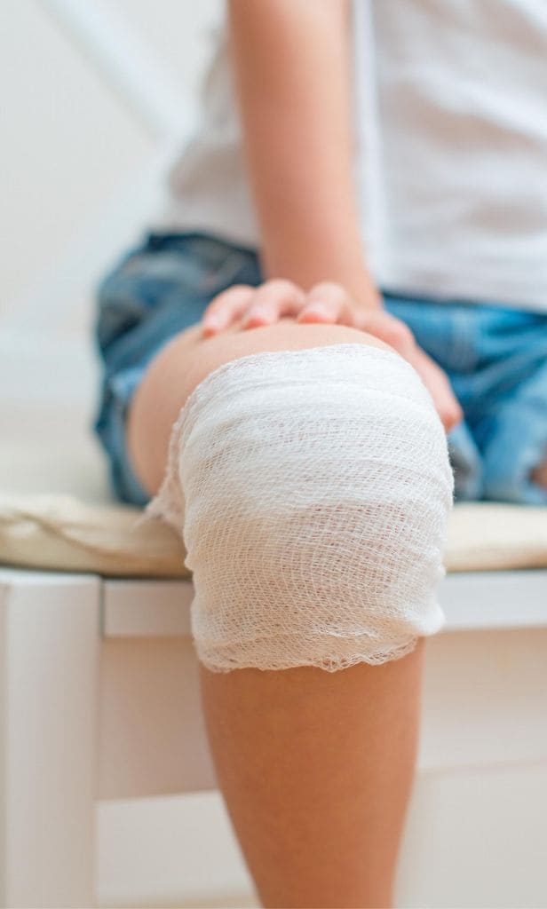 Tratar cicatrices en niños