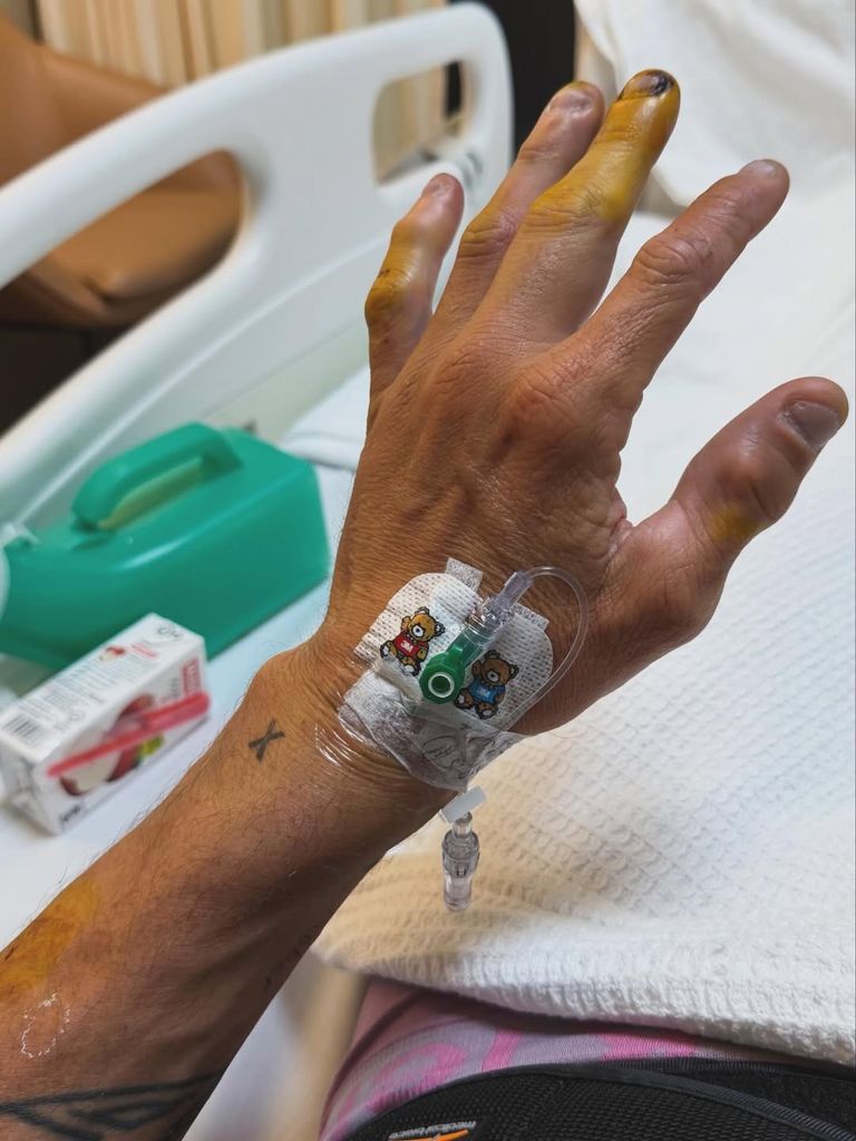 El piloto Aleix Espargaró sufre un accidente muy grave en el circuito de Malasia