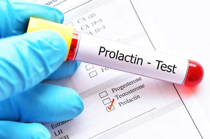 test de prolactina