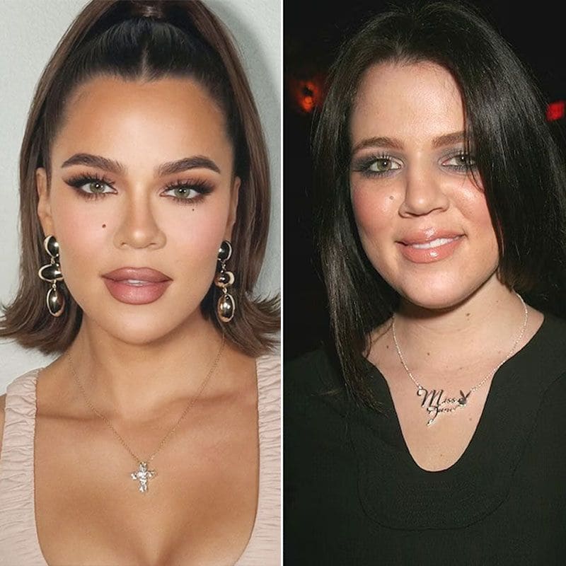 Khloé Kardashian