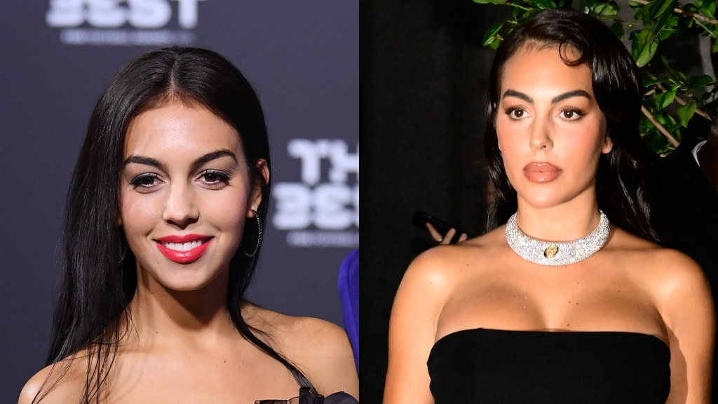 Georgina antes y después