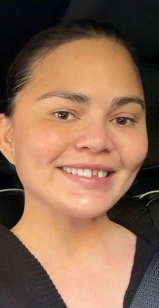 Chrissy Teigen se fue al festival escolar de sus hijos sin la carilla.