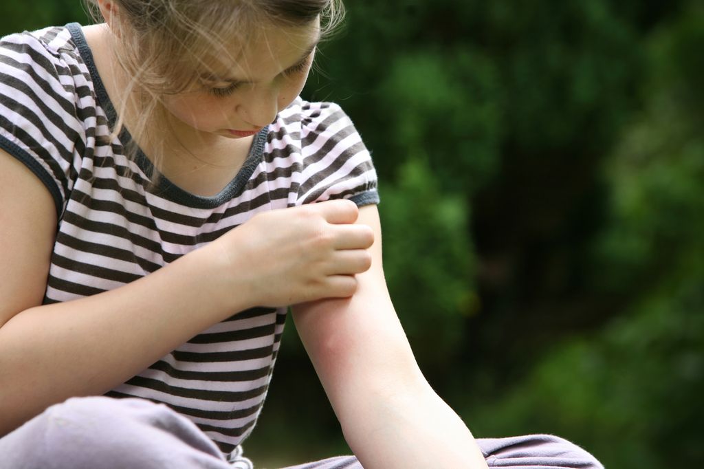 Niña rascándose el brazo por una alergia