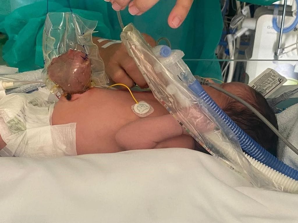 Diego, el hijo mayor de Lucía Villalón, hospitalizado al nacer