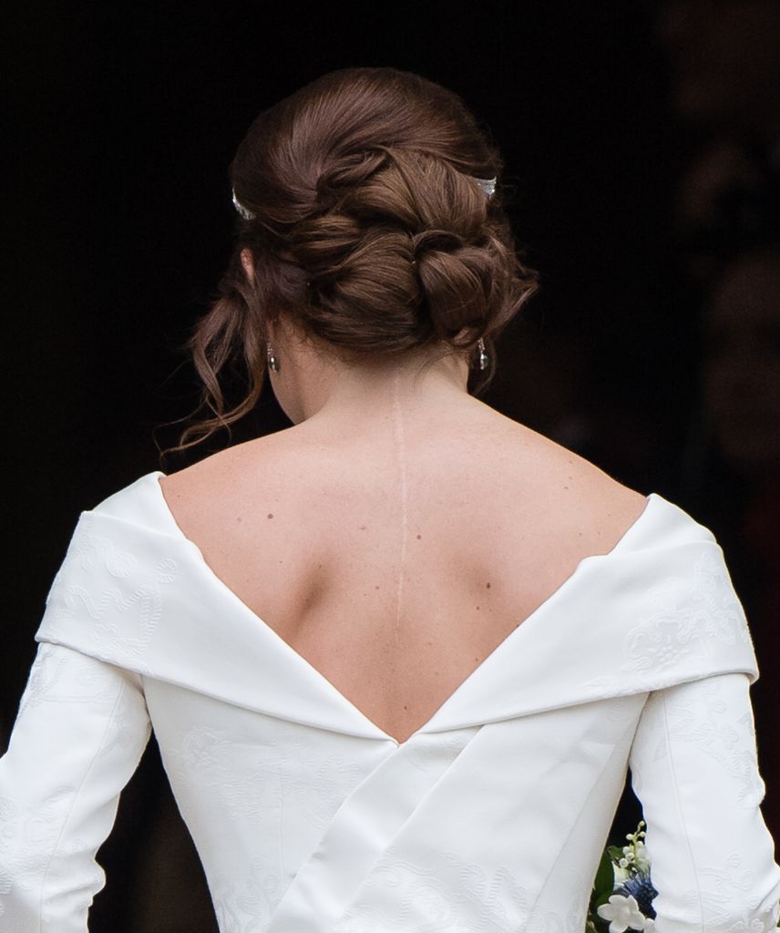 Boda de Eugenia de York y Jack Brooksbank peinado y cicatriz en la espalda
