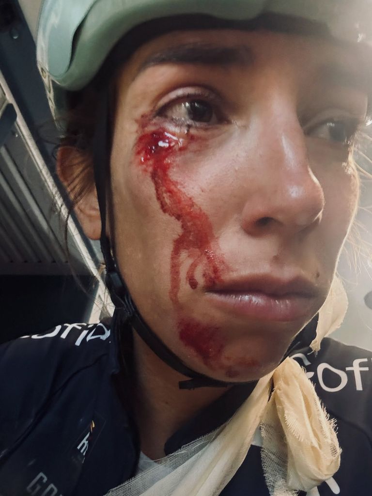 Sandra, tras el impactante accidente