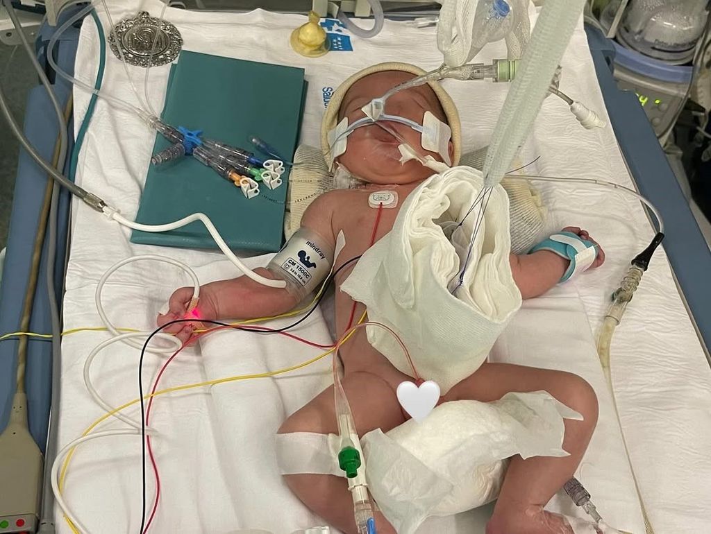 Diego, el hijo mayor de Lucía Villalón, hospitalizado al nacer