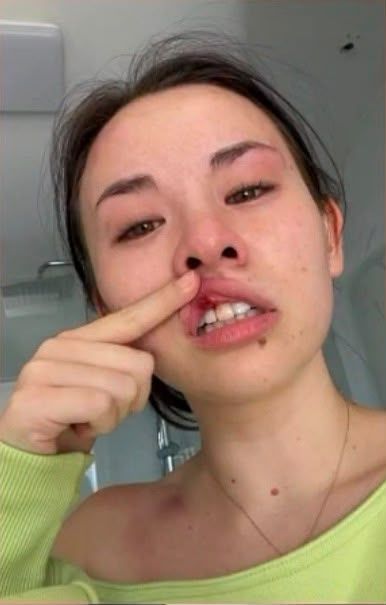 María Reus Huang sufre una paliza