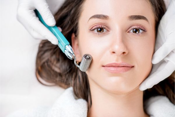 Puedes tener sesiones de microneedling con un profesional