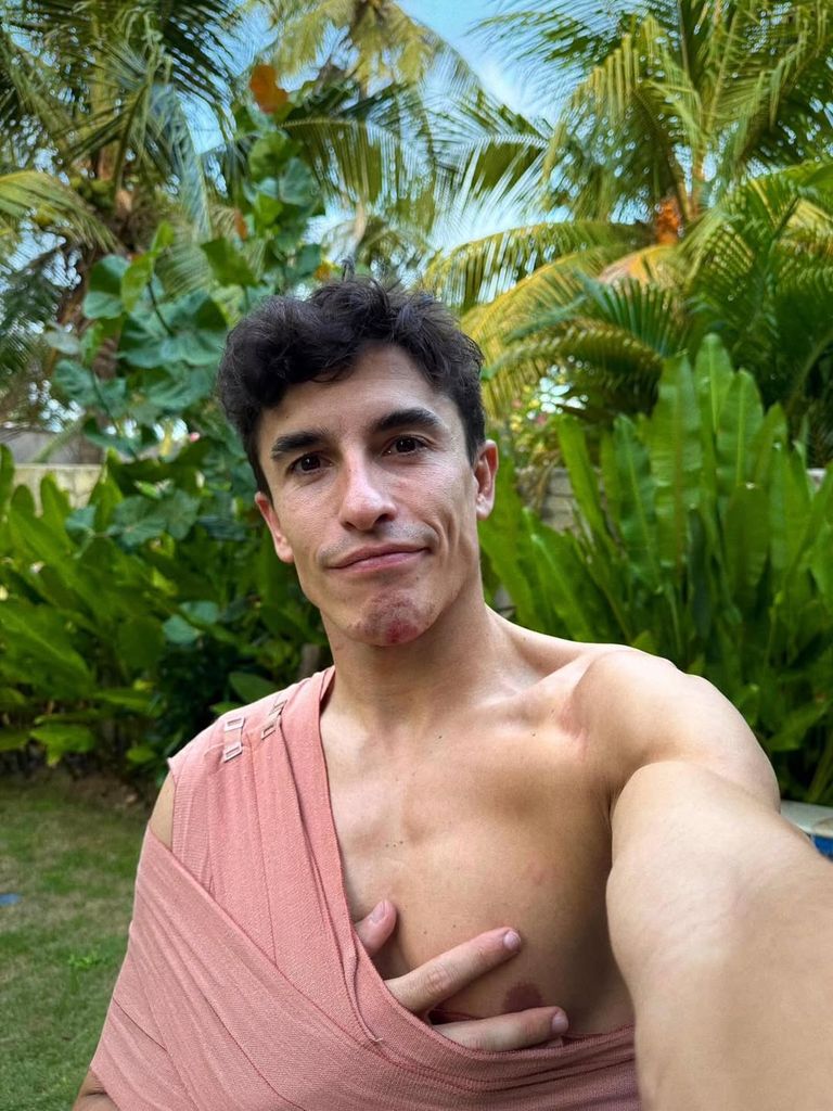 Marc Márquez se lesiona el brazo en el circuito de Indonesia