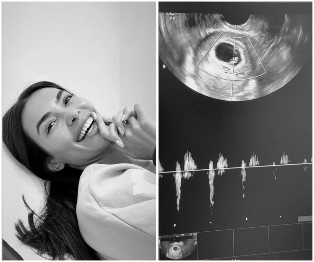 Joana Sanz compartió su alegría del momento que escuchó el corazón de su bebé por primera vez.