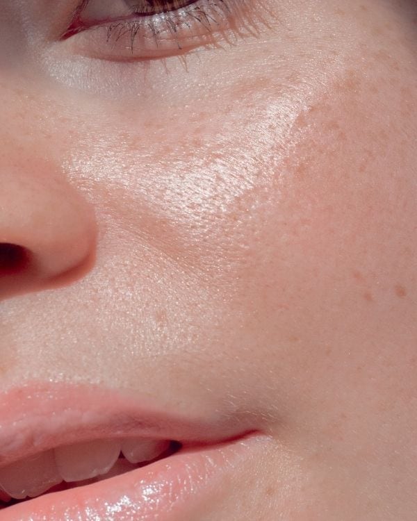 Rostro de mujer con piel hidratada