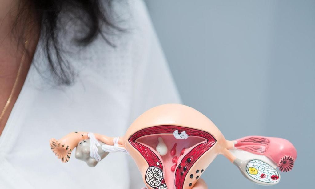 doctora mostrando el funcionamiento de un diu en un tero