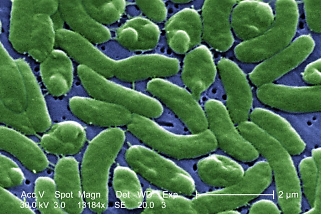Así es Vibrio vulnificus, la conocida como "bacteria come carne", vista al microscopio