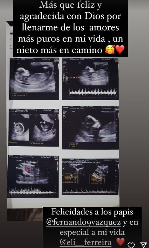 Mamá de Nadia anuncia que su hija Eli está embarazada
