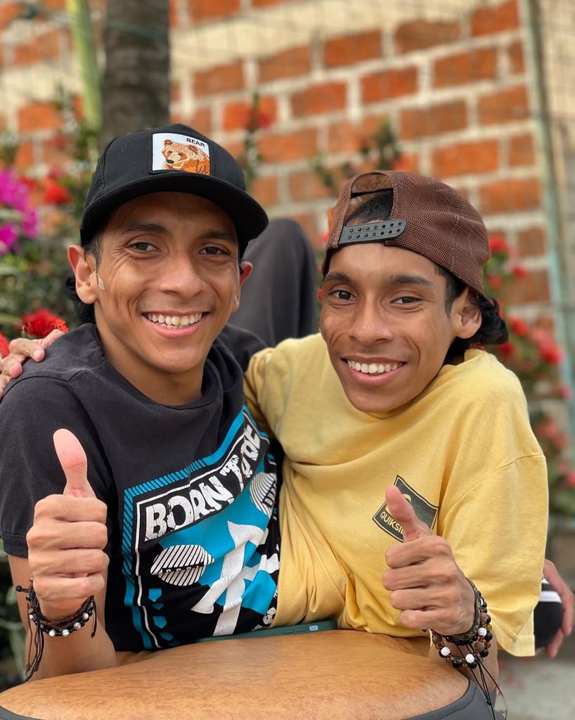 Mueren a los 27 años José Luis y José Armando, los hermanos siameses que desafiaron todos los pronósticos