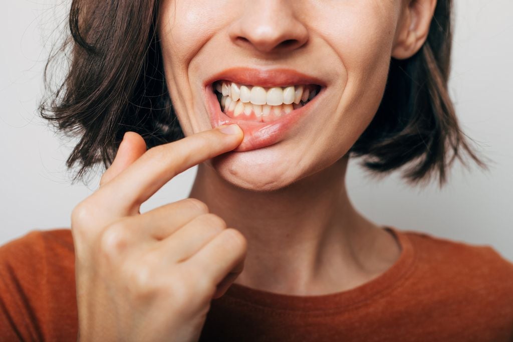 Mujer con periodontitis tocándose la boca