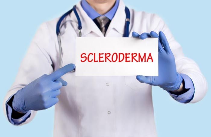 esclerodermia