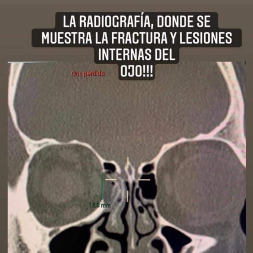 Eduardo Capetillo denuncia golpiza a su primo