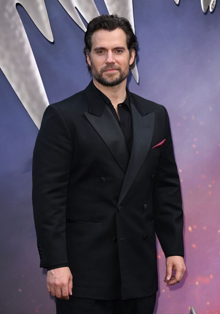 Henry Cavill sufrió una lesión mientras se preparaba para su nueva película.
