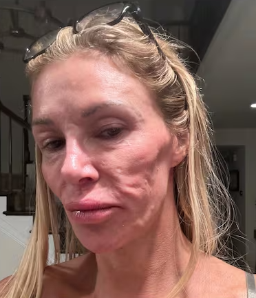 Su cara quedó irreconocible 