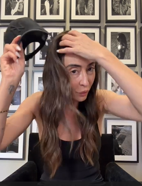 Rocío Martín Berrocal se quita la gorra para mostrar su lesión en la piel