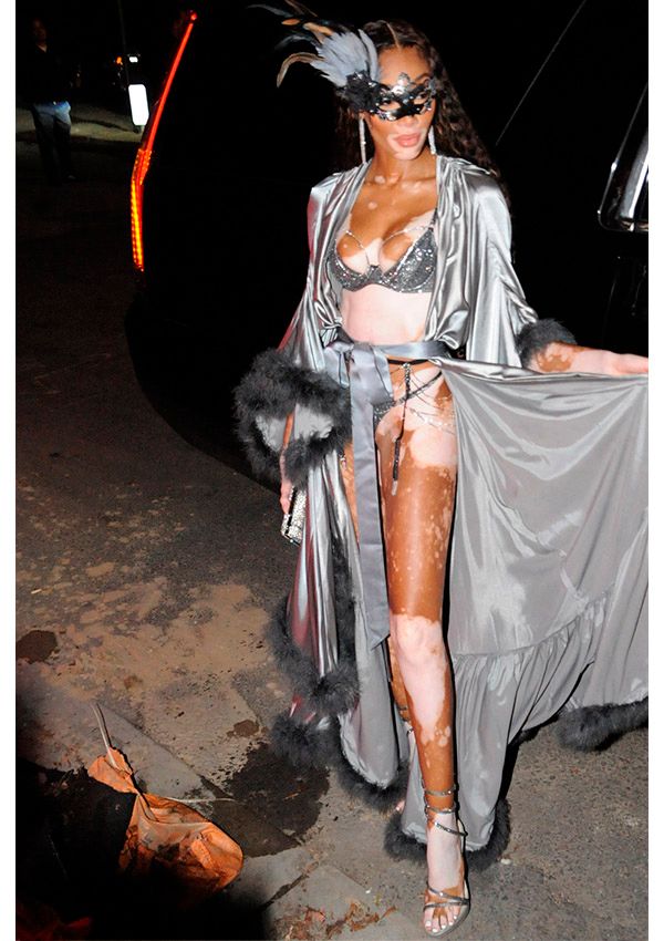 winnie-harlow
