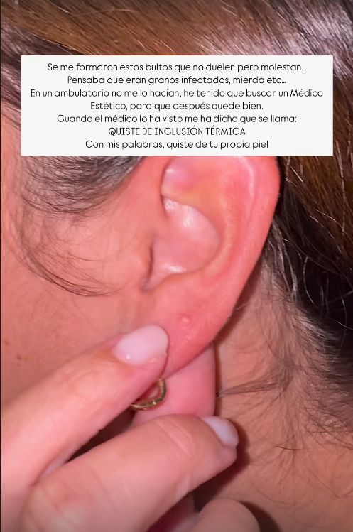 Anabel Pantoja anuncia que ha sido intervenida quirúrgicamente