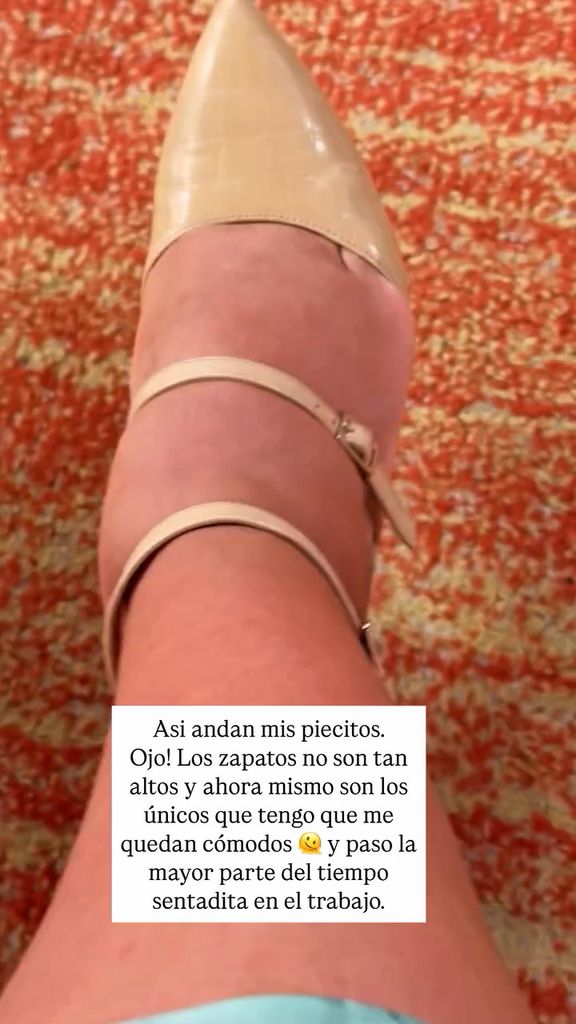 Francisca también dejó ver que sus pies están bastante hinchados
