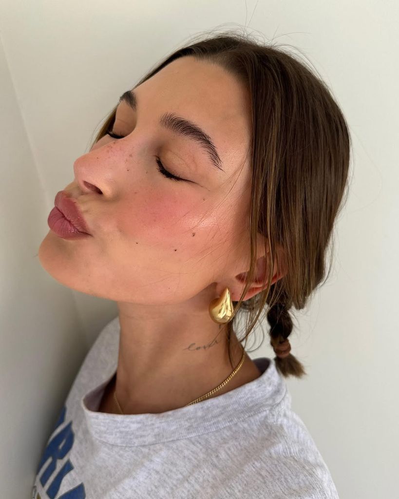 Hailey Bieber dermatitis