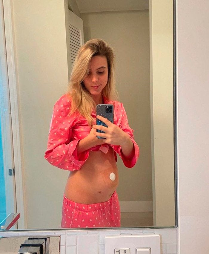 lele-pons-apendicitis